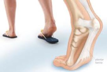 Foot Evaluation and Orthotics