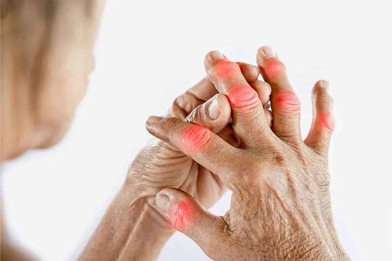 Chiropractic Care for Arthritis | Chirosport Health Center